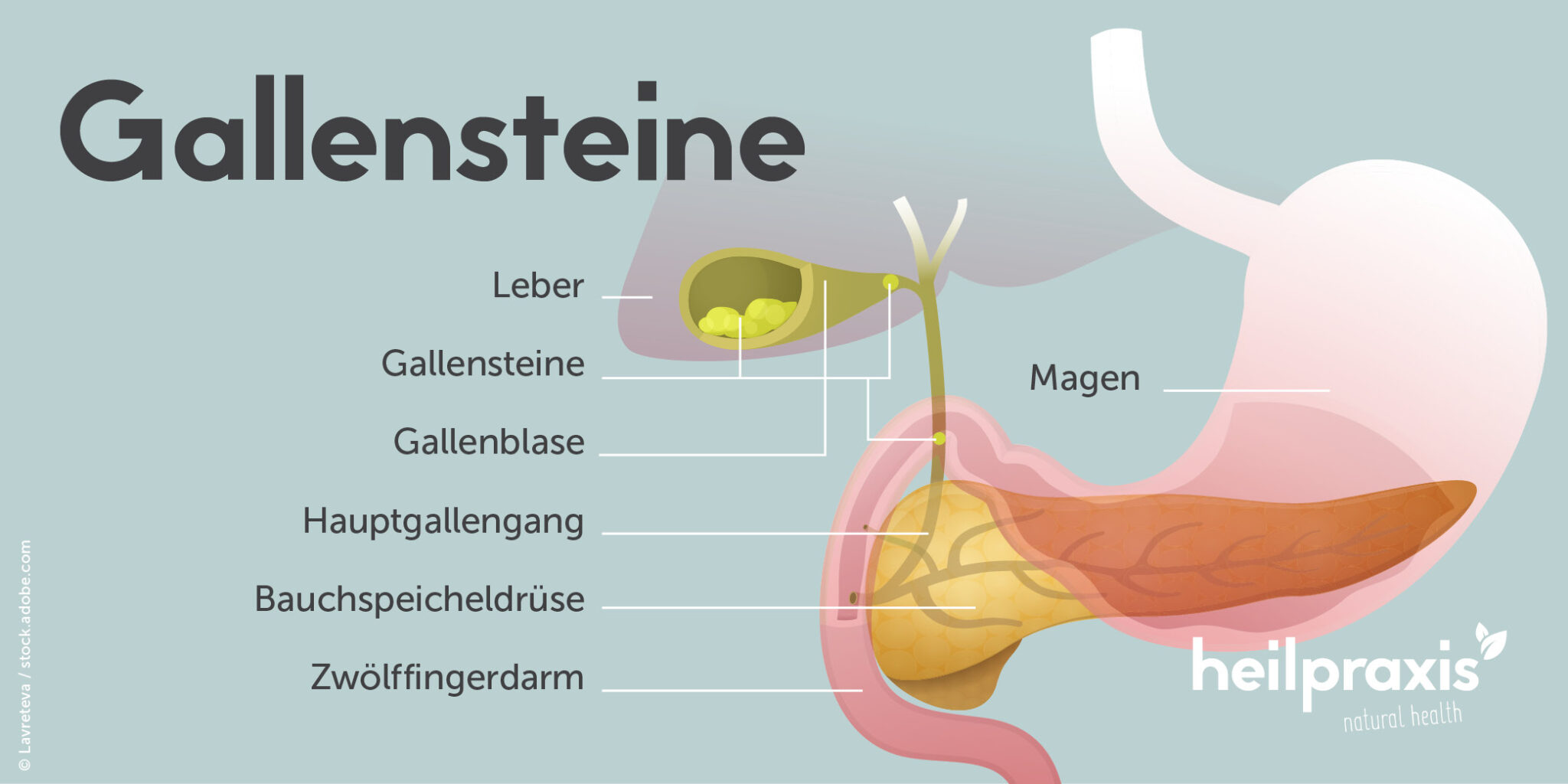 Gallensteine Symptome, Ursachen und Therapie Heilpraxis