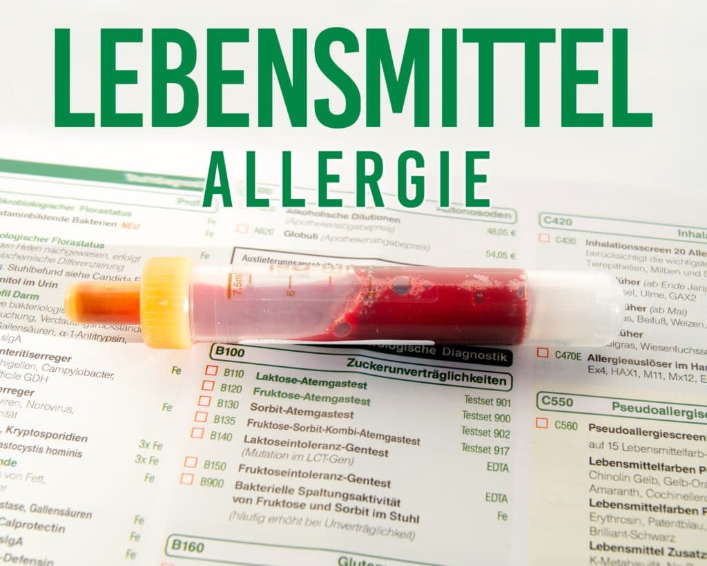 Blutprobe Lebensmittelallergie