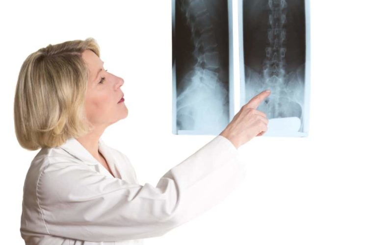 Spondylarthrose – Symptome, Ursachen und Behandlung – Heilpraxis