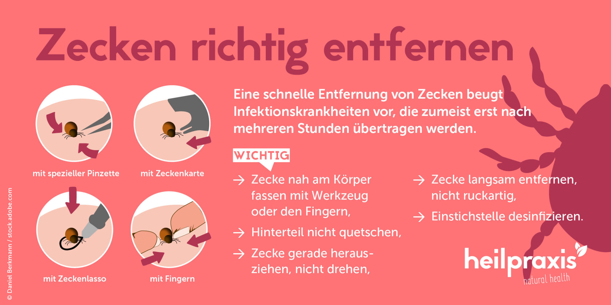 Zecke Kopf Stecken Geblieben Borreliose www.heilpraxisnet.de