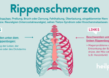 Schematische Darstellung der Rippen und möglicher Ursachen für Rippenschmerzen.
