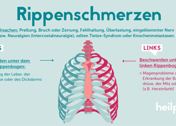 Schmerzen An Der Rippe Rechts www.heilpraxisnet.de