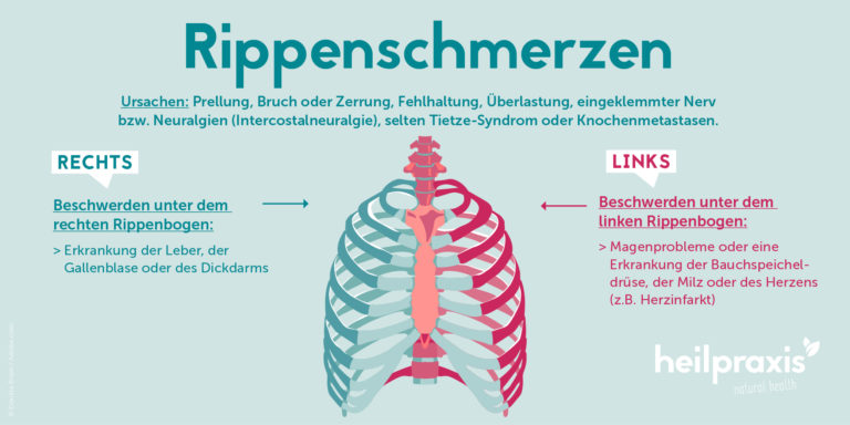 Rippenschmerzen rechts oder links – Heilpraxis