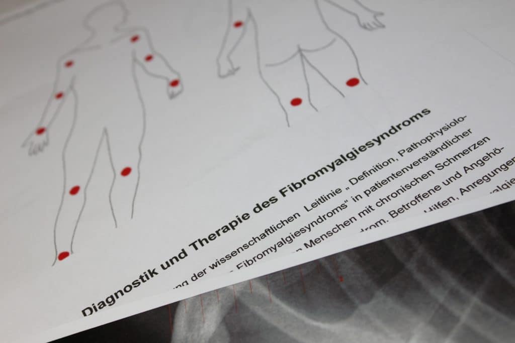 Fachliteratur Fibromyalgie