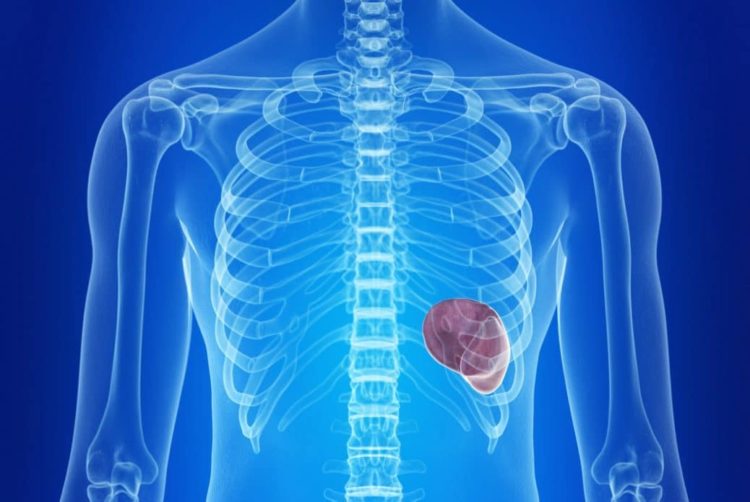Milzinfarkt – Symptome, Ursachen und Behandlung – Heilpraxis