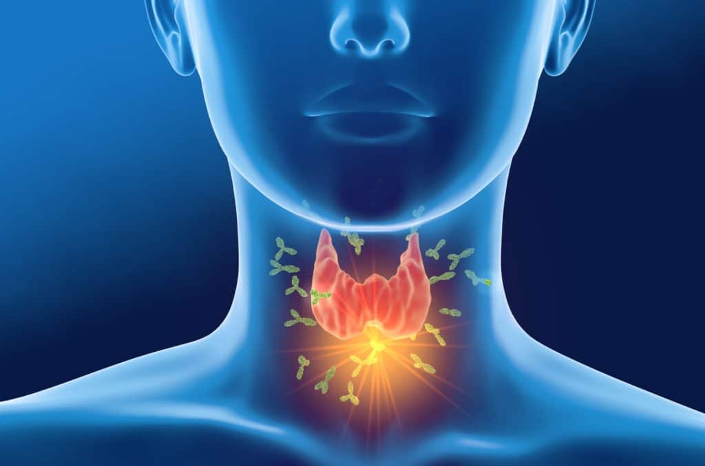Autoantikoerper gegen Schildddruese