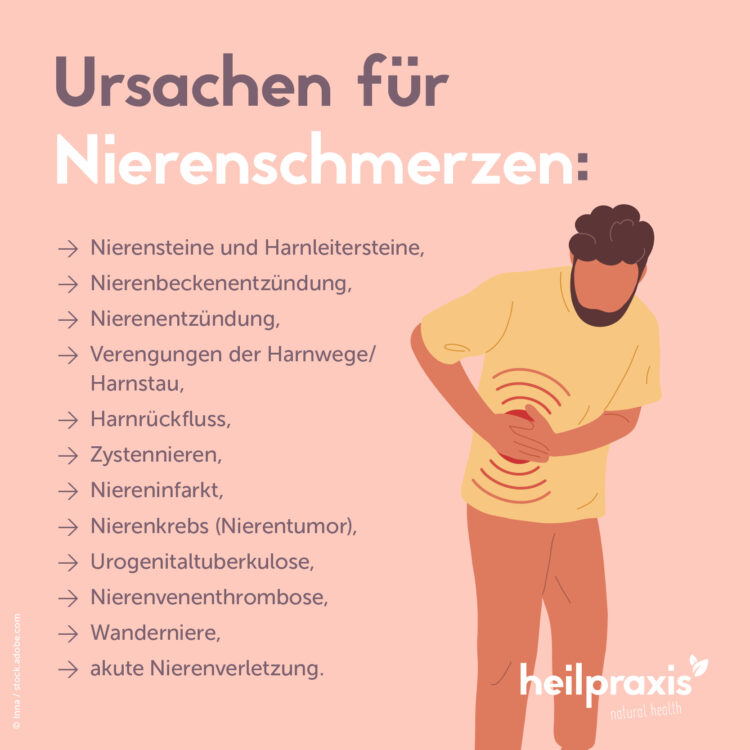 Liste der möglichen Ursachen bei Nierenschmerzen.