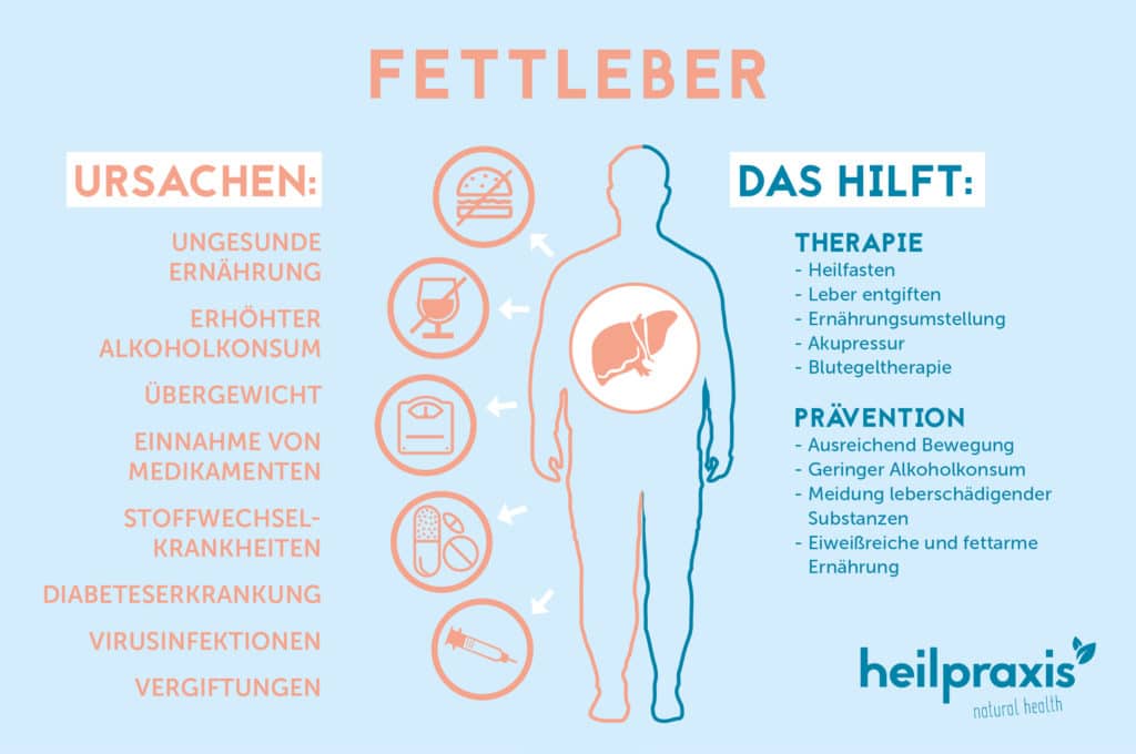 Schematische Körperdarstellung mit Ursachen und Behandlungsoptionen der Fettleber.