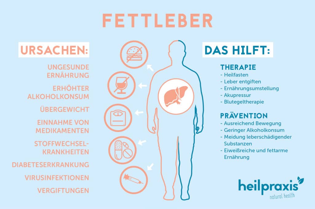 Fettleber: Neue Auslöser und Behandlungsmöglichkeit entdeckt – Heilpraxis