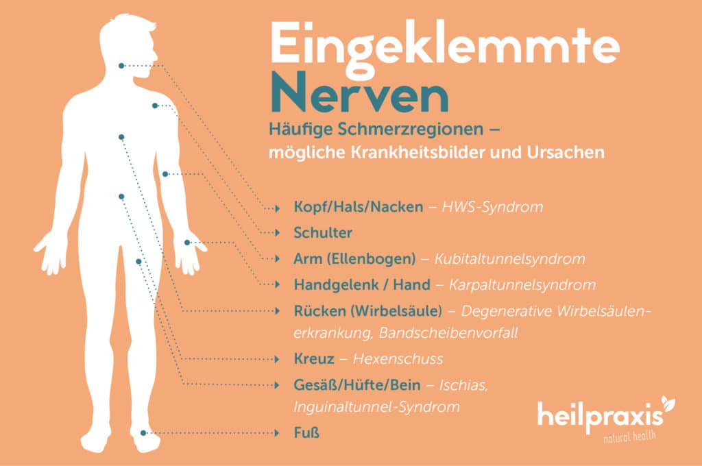 Grafik Heilpraxis eingeklemmte Nerven