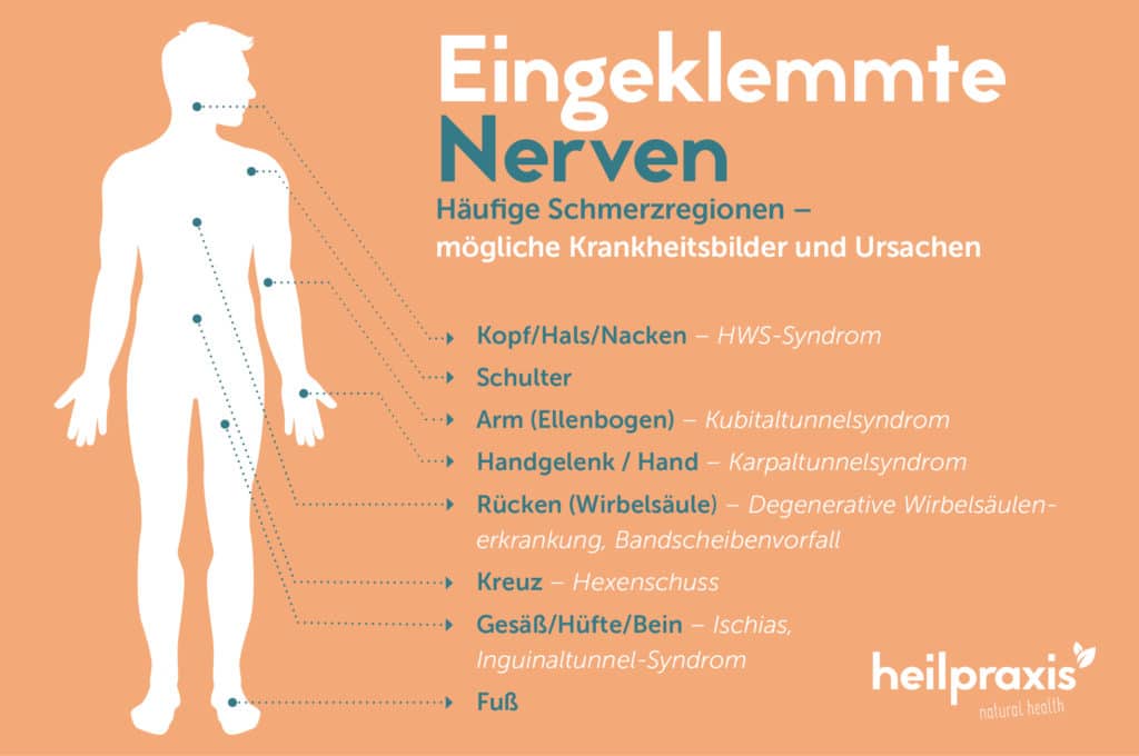 Grafik Heilpraxis eingeklemmte Nerven