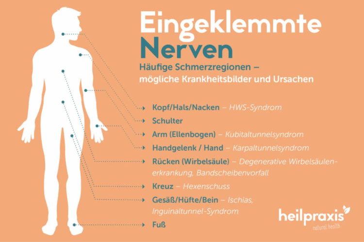 Bei Op Nerv Verletzt Was Tun www.heilpraxisnet.de