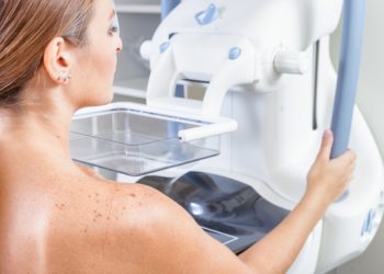 Frau bei einer Mammograhpie-Untersuchung