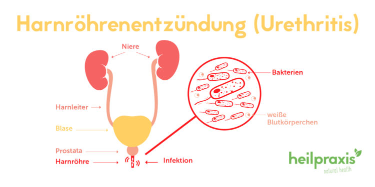 Der blase eichel an Blasen an