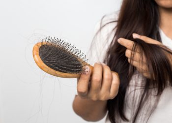 Junge Frau mit einer Haarbürste voller ausgefallener Haare