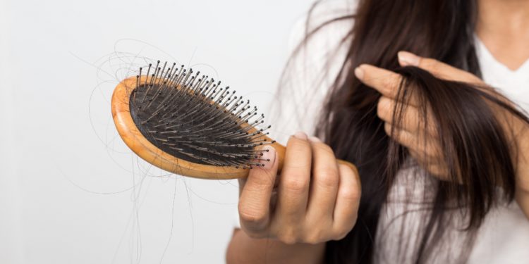 Junge Frau mit einer Haarbürste voller ausgefallener Haare