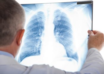 Wennn Lungenkrebs frühzeitig bei Menschen festgestellt wrid, verbessert dies ihre Überlebenschance. (Bild:  Minerva Studio/Stock.Adope.com)