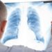 Wennn Lungenkrebs frühzeitig bei Menschen festgestellt wrid, verbessert dies ihre Überlebenschance. (Bild:  Minerva Studio/Stock.Adope.com)