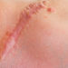 Eine aktuelle Studie ordnet der Faszie eine wesentliche Rolle bei dem Prozess der Narbenbildung zu. (Bild: damato/stock.adobe.com)