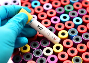 Wird ein neu entdeckter Stamm von HIV für eine neue Infektionswelle sorgen? (Bild: jarun011/Stock.Adobe.com)