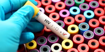 Wird ein neu entdeckter Stamm von HIV für eine neue Infektionswelle sorgen? (Bild: jarun011/Stock.Adobe.com)
