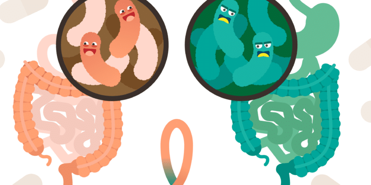 Zeichnung zweier Verdauungssysteme, eins mit guten eines mit schlechten Darmbakterien.