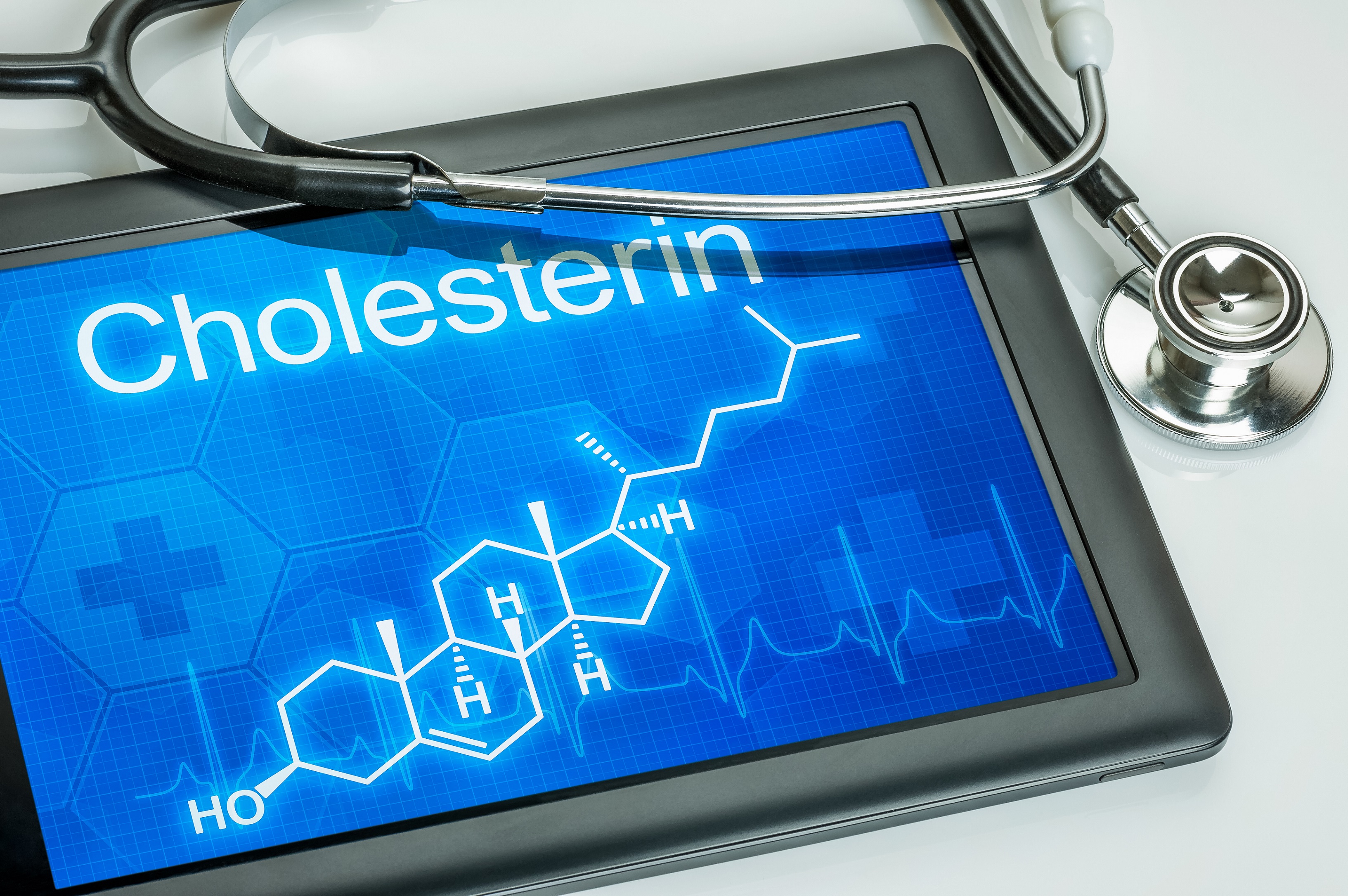 Krebs: Wie hohes Cholesterin Krebserkrankungen fördert - Vimarsana News