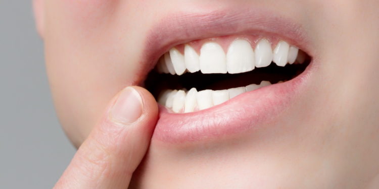 Zahnschmerzen am Zahn