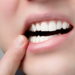 Zahnschmerzen am Zahn