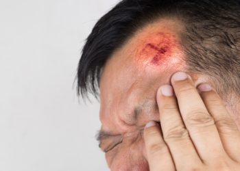 Menschen mit Alzheimer erleiden häufiger Kopfverletzungen, wenn sie Antipsychotika einnehmen. (Bild:  ThamKC/Stock/Adobe.com)
