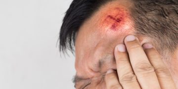 Menschen mit Alzheimer erleiden häufiger Kopfverletzungen, wenn sie Antipsychotika einnehmen. (Bild:  ThamKC/Stock/Adobe.com)
