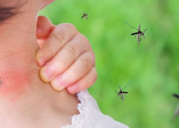 Junges Mädchen mit einem roten Ausschlag am Nacken nach einem Stich einer Mücke