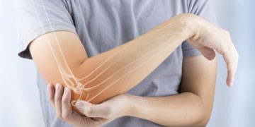 In der Komplementärmedizin wird Thujaöl zur Behandlung chronischer Schmerzen eingesetzt, beispielsweise bei rheumatischen Beschwerden. (Bild: TANABOON/stock.adobe.com)