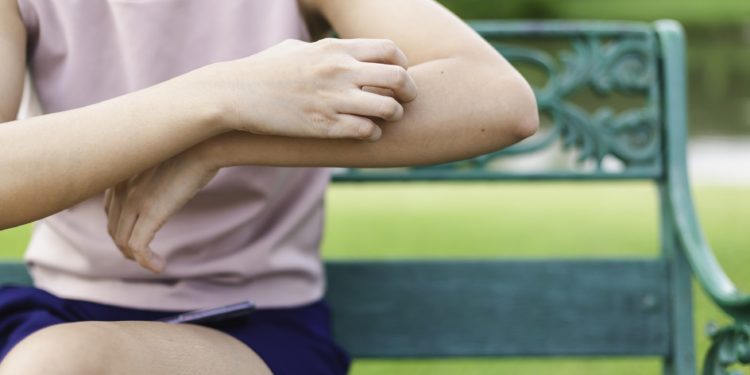 Eine Frau sitzt auf einer Parkbank und kratzt sich mit der rechten Hand am linken Unterarm.