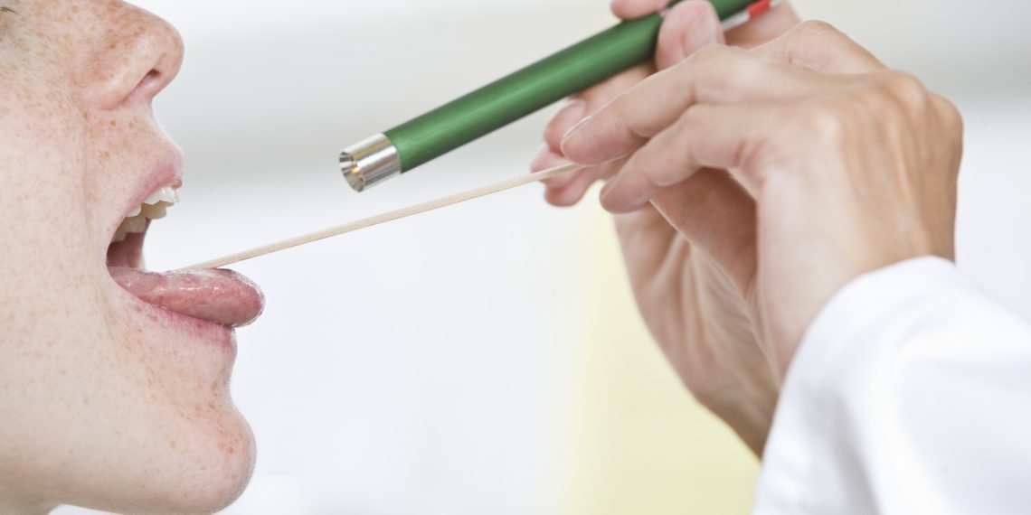 Rödern (Roederbehandlung) – Entfernung der Mandelsteine – Heilpraxis