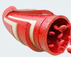 Eine grafische Darstellung der verschiedenen Schichten einer Arterie.