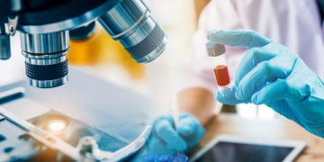 Wird ein neuer Blutttest die Diagnose von Eierstockkrebs verbessern und so vielen Frauen weltweit das Leben retten? (Bild: totojang1977/Stock.Adobe.com)