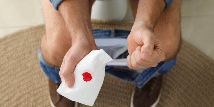 Auf der Toilette sitzender Mann hält Toilettenpapier mit einem Blutfleck