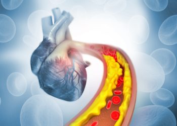 Den Begriff Cholesterin kennen die meisten Personen, aber wissen Sie auch genau, was sich dahinter verbirgt? (Bild: Rasi/stock.adobe.com)