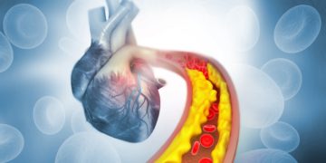 Den Begriff Cholesterin kennen die meisten Personen, aber wissen Sie auch genau, was sich dahinter verbirgt? (Bild: Rasi/stock.adobe.com)
