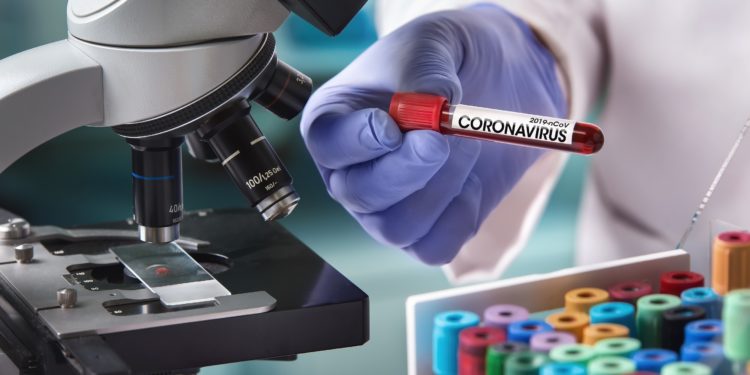 Hand hält ein Laborproben-Röhrchen mit der Aufschrift Coronavirus.