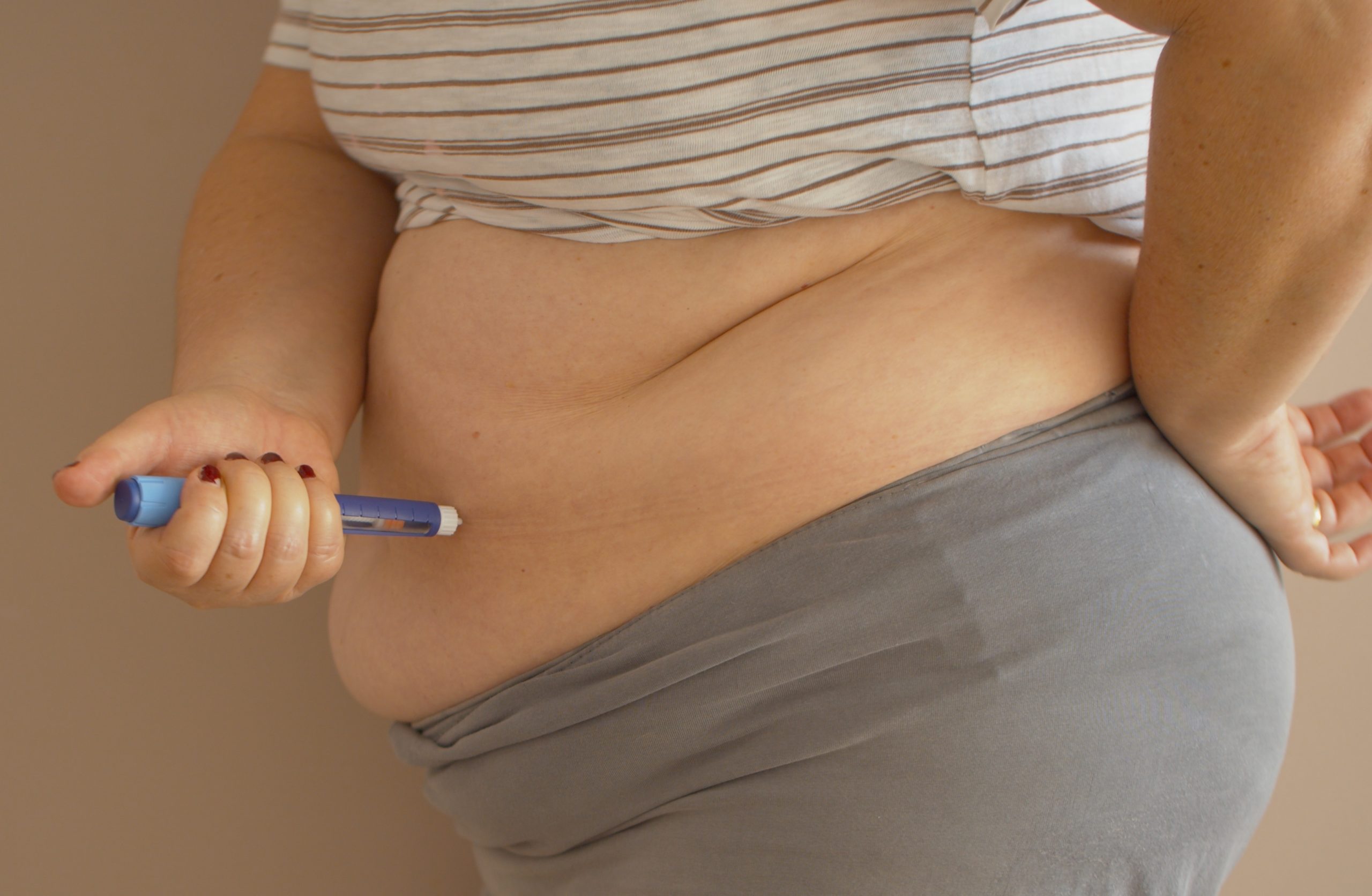 Колят беременным в живот. Гормональные уколы в живот. Укол инсулина в живот. Уколы клексан при беременности. Клексан подкожно в живот.