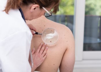 Eine Untersuchung unserer Haut kann Hinweise auf eine Erkrankung durch Hautkrebs geben. (Bild: thodonal/Stock.Adobe.com)