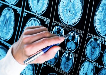 Könnten Bakterien und Viren der Auslöser für Alzheimer sein? (Bild:  BillionPhotos.com/Stock.Adobe.com)