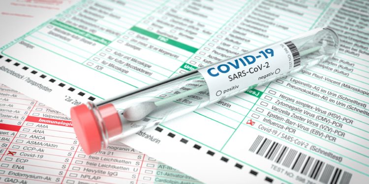 COVID-19-Abstrich-Teströhrchen auf Testformular