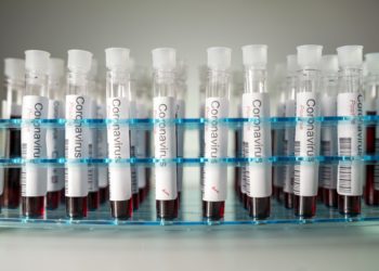 Mehrere mit Blut gefüllte Coronavirus-Test-Reagenzgläser