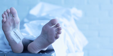 Eine Person liegt auf einer Liege und ist mit einem weißen Tuch zugedeckt.