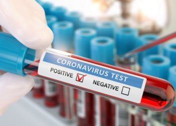 Hilft ein neuer Test Corona frühzeitig zu diagnostizieren? (Bild: Maksym Yemelyanov/Stock.Adobe.com)