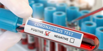 Hilft ein neuer Test Corona frühzeitig zu diagnostizieren? (Bild: Maksym Yemelyanov/Stock.Adobe.com)