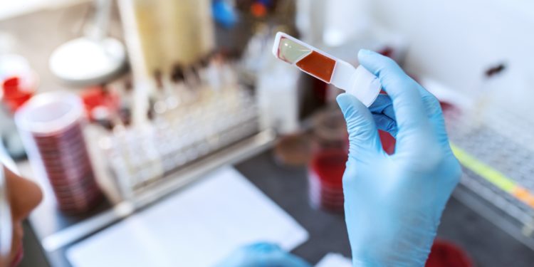 Eine Person betrachtet eine Blutprobe im Labor.